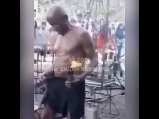 Эпиляция