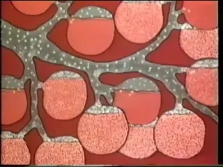 M e д ф и л ь м удушье в тч и при covid19 отек легких скорая помощь pulmonary edema respiratory distress