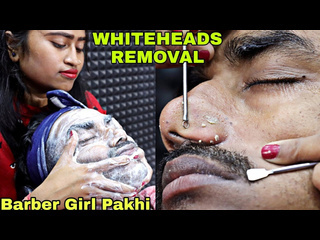 Asmr clinic whiteheads removal amp face wash by barber girl pakhi head massage amp face cleaning neck cracking